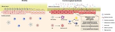 Interactions between microbiota and cervical epithelial, immune, and mucus barrier